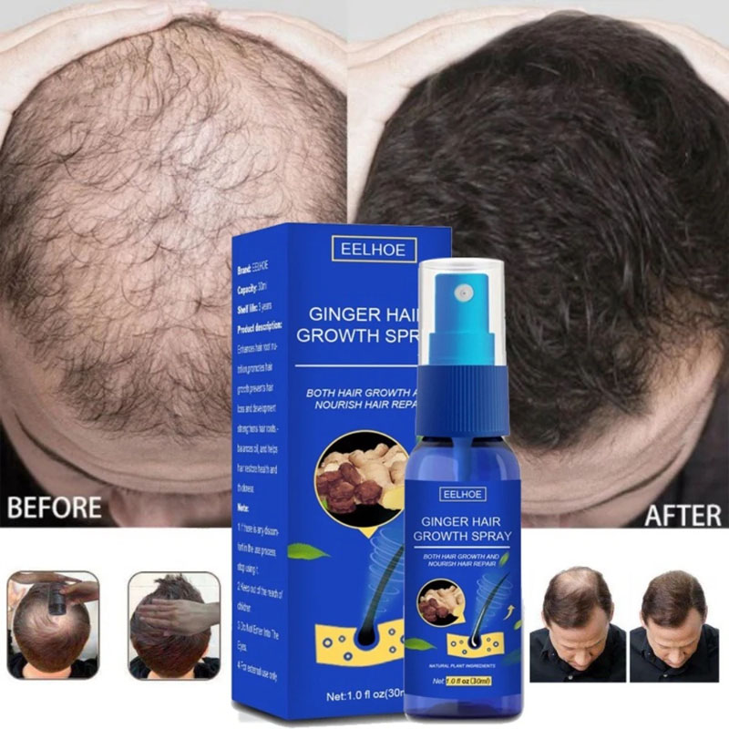Epidermal Growth Factor - Semprotan Serum Penumbuh Rambut Jahe Anti