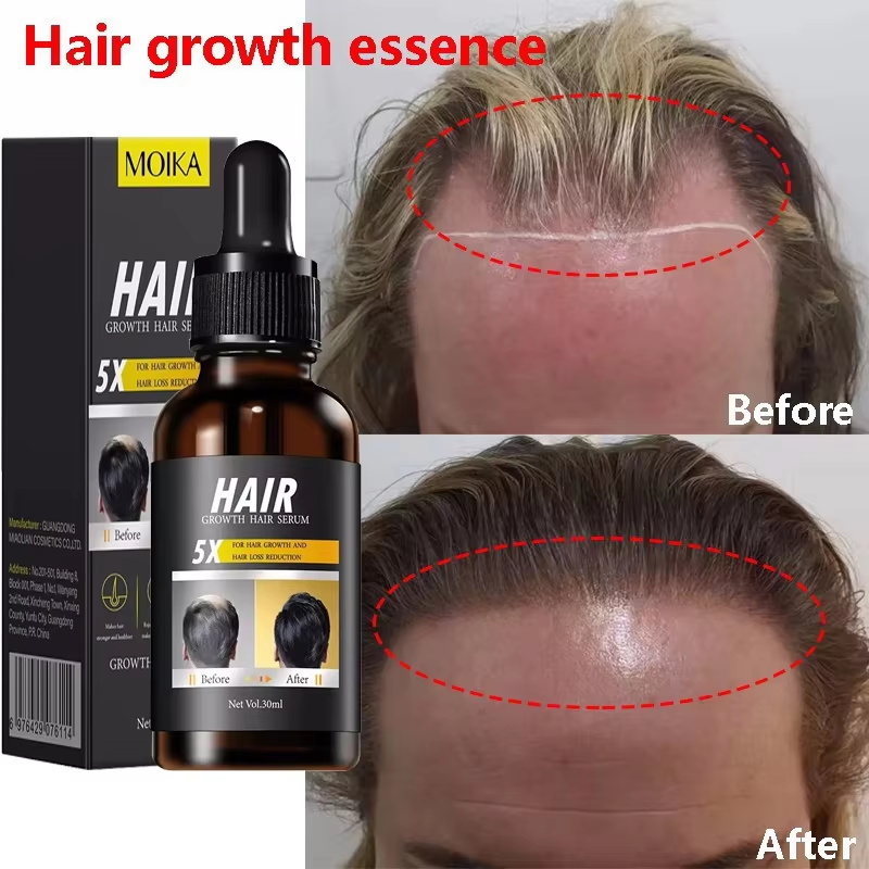 Epidermal Growth Factor - Serum Penumbuh Rambut Cepat Minyak Esensial