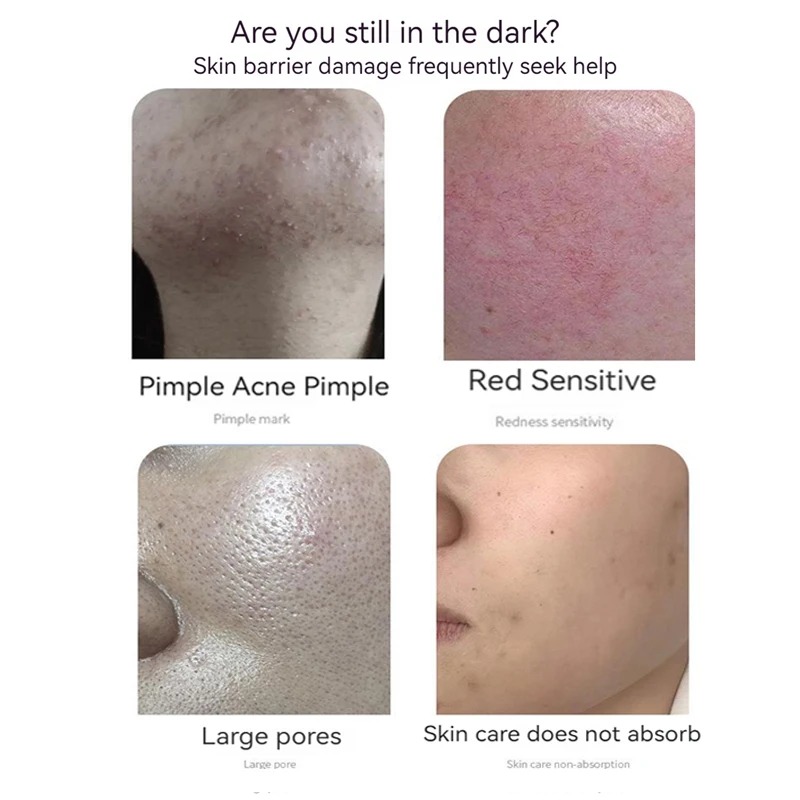 Perawatan kulit Anti Keriput,  - Oligopeptide Wrinkle ulasan dan harga