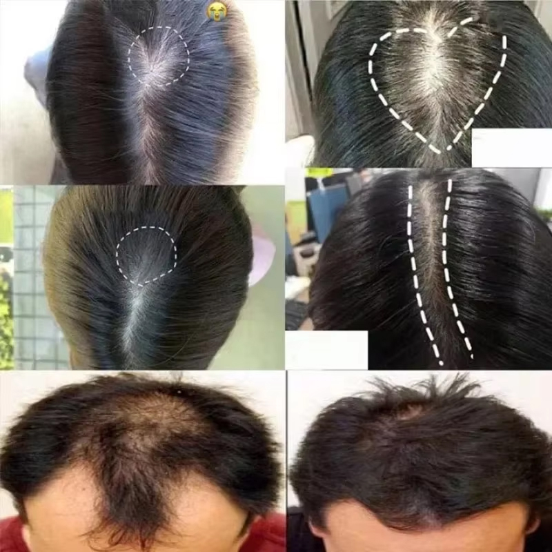 Semprotan Serum Penumbuh Rambu - Epidermal Growth Factor ulasan dan harga