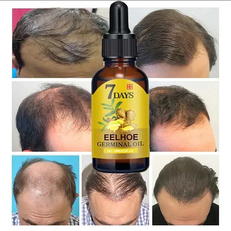 Minyak penumbuh rambut cepat 7 - Epidermal Growth Factor ulasan dan harga