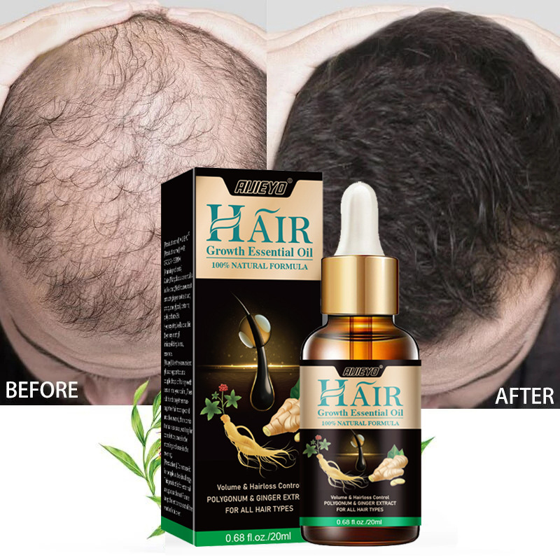2023 Biotin minyak penumbuh ra - Epidermal Growth Factor ulasan dan harga