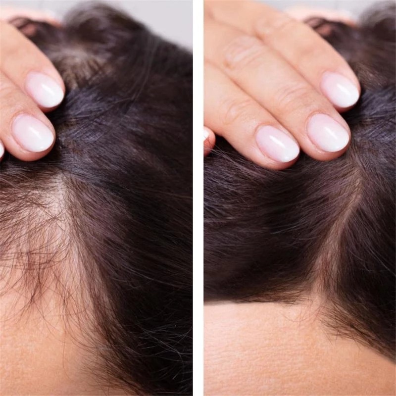 2023 Biotin minyak penumbuh ra - Epidermal Growth Factor ulasan dan harga