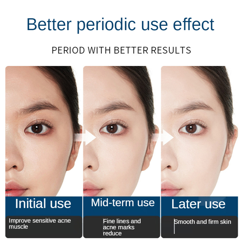 Perbaikan Wajah Set Bubuk Terl - Oligopeptide Wrinkle ulasan dan harga