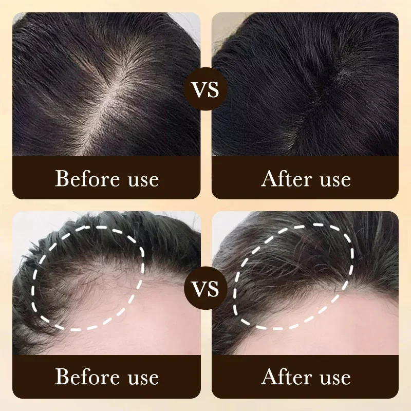 Produk Minyak Penumbuh Rambut  - Epidermal Growth Factor ulasan dan harga