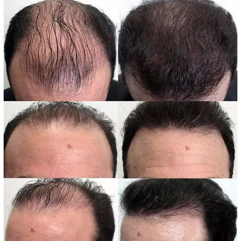 Serum Penumbuh Rambut Cepat Mi - Epidermal Growth Factor ulasan dan harga