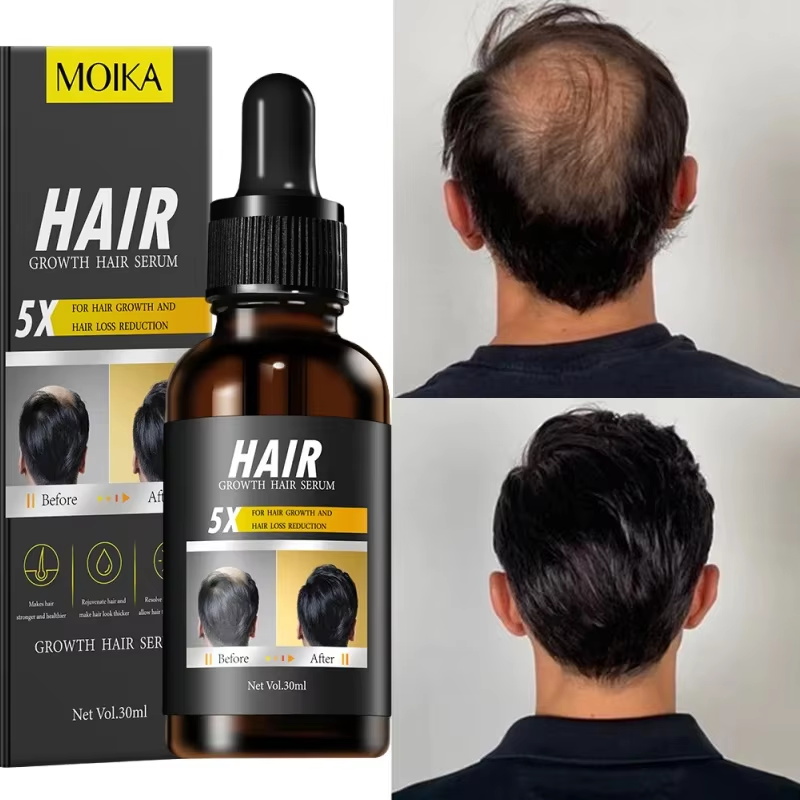 Serum Penumbuh Rambut Cepat Mi - Epidermal Growth Factor ulasan dan harga